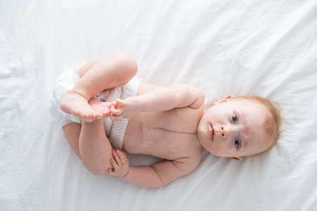 baby with a scar from heart surgery