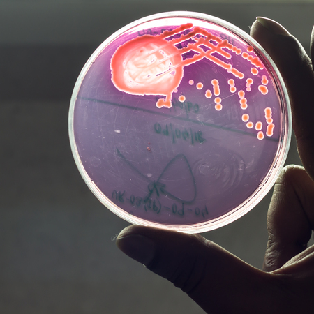 Bacterial culture plate showing growth of bacterial colony in mac conkey blood agar held by hand