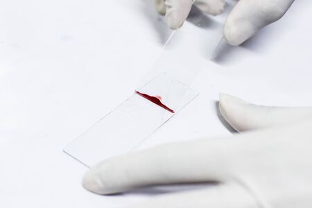 smear drawing of blood by glass slide
