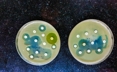 two culture media plate showing bacterial growth inhibition antibacterial sensitivityの写真素材