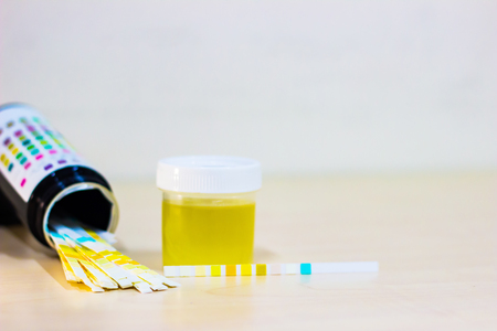 urine sample along with dip stick uristix for analyzing urine glucose protein in diabetesの写真素材