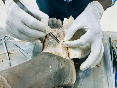 Anatomy dissection of a cadaver showing dorsum of foot using scalpel scissors and forceps cutting skin flap revealing important structures arteries veins nervesの写真素材