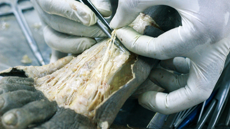 Anatomy dissection of a cadaver showing dorsum of foot using scalpel scissors and forceps cutting skin flap revealing important structures arteries veins nervesの写真素材