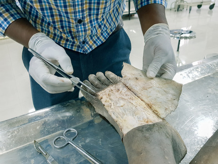 Photo of Anatomy dissection of a - ID:1-105982264 - Royalty Free Image ...