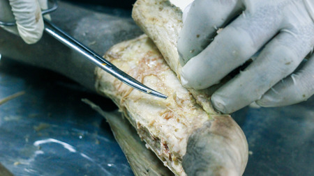 Anatomy dissection of a cadaver showing dorsum of foot using scalpel scissors and forceps cutting skin flap revealing important structures arteries veins nervesの写真素材
