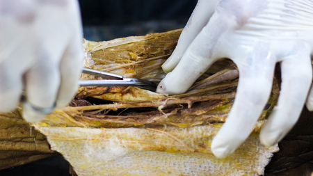 Anatomy dissection of a cadaver showing adductor canal using scalpel scissors and forceps cutting skin flap revealing important structures arteries veins nervesの写真素材