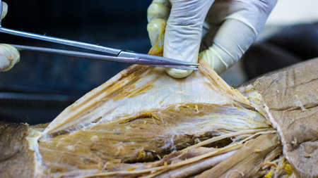 Anatomy dissection of a cadaver showing adductor canal using scalpel scissors and forceps cutting skin flap revealing important structures arteries veins nervesの写真素材