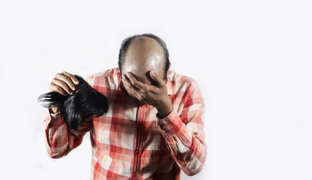 bald man covering his face in shame holding his wig in white background with space for text