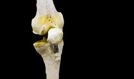 photograph of articulated knee joint in black background