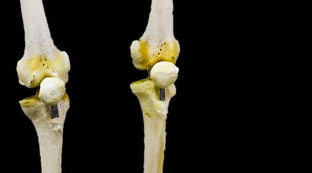 photograph of bilateral articulated knee joint in black background