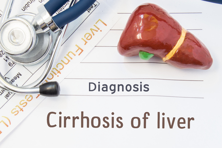 Cirrhosis of the liver diagnosis. Anatomical 3D model of human liver is near stethoscope, results of laboratory tests of liver function and printed on notepad diagnosis of Cirrhosis of liverの写真素材