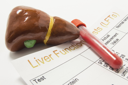 Figure of human liver, laboratory test tube or bottle with blood and paper result of liver function or enzyme test (LFTs) analysis are on doctor table. Concept to represent liver function test or examの写真素材