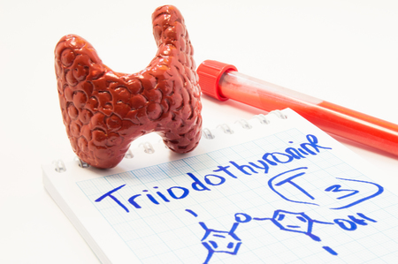 Thyroid gland hormone Triiodothyronine. Model of thyroid, laboratory test tube with blood and notebook inscribed with Triiodothyronine T3 with it chemical formula. Concept for hormonal thyroid diseaseの写真素材