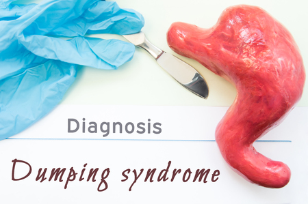 Diagnosis of Dumping syndrome. Figure stomach, scalpel and surgical gloves lie near title Diagnosis Dumping syndrome. Concept of causes, symptoms, diagnostic, treatment and diet in stomach diseaseの写真素材