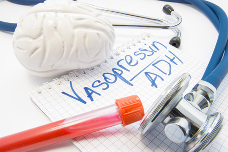 Lab test tube with blood stethoscope brain lie near note labeled hormone Vasopressin or antidiuretic hormone ADH. Diagnosis vasopressin level, function and reason for development of diabetes insipidusの写真素材