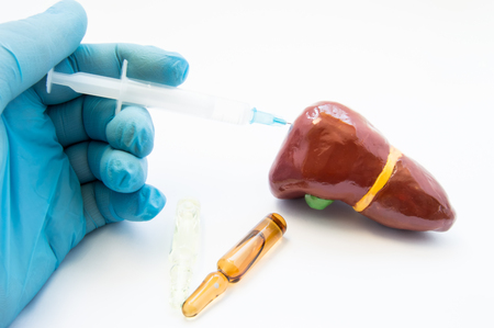 Doctor conducts liver treatment or detox by injecting medication using syringe in 3D model of organ. Concept photo symbolizing process of treatment of liver diseases - hepatitis C, cirrhosis, alcoholの写真素材