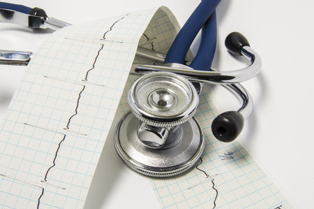 ECG line on paper and stethoscope lying on a white table in medical doctor's office. Concept for exam or diagnosis in cardiology and internal medicine, representing the health or pathology of heartの写真素材