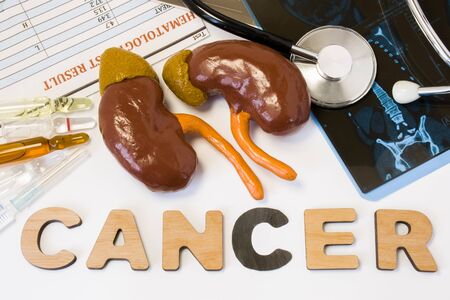 Kidney cancer concept. Anatomical shape of kidneys with adrenal lies near word cancer surrounded by...
