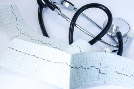 Stethoscope with black air duct tube located near the tape of electrocardiogram (ECG) with one line...
