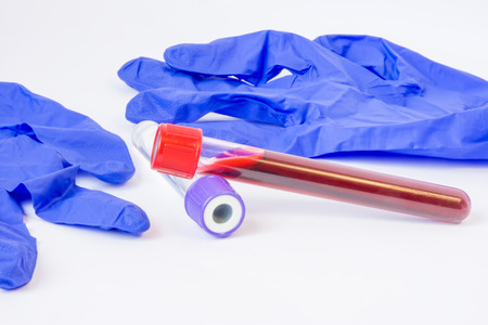 Two laboratory test tubes with blood, plasma or other biological fluid samples are on table near protective latex gloves on white background. Concept photo for clinical laboratory tests to determineの写真素材