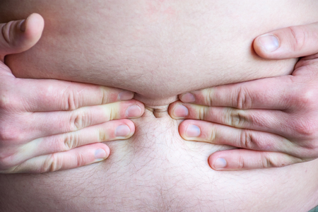 Human put his hands on abdomen near navel, indicating localization of severe pain in middle of...