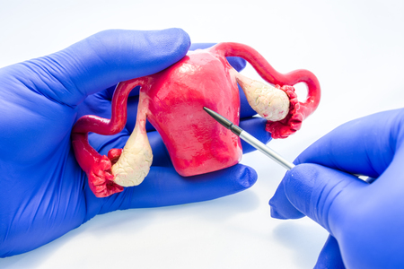Doctor or scientist holds in gloved hand anatomical model of female uterus with ovaries and points with pointer on uterine body in other hand. Study or explanation of anatomy and physiology of organの写真素材
