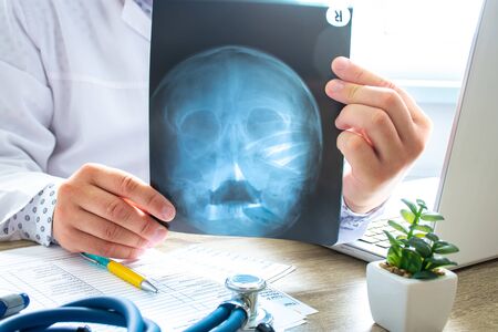 Doctor examines x-ray scan of head and skull near computer during work and patient advice in office....