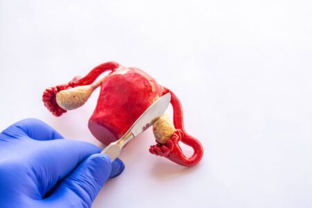 Concept of photo of ovariectomy or oophorectomy - total or part ovaries surgery or female operation....