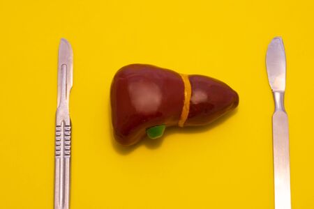 Concept photo of surgical treatment of liver and gallbladder. Anatomical figure of liver lies on yellow background, next to two chrome metal scalpels. For use in hepatobiliary surgeryの写真素材