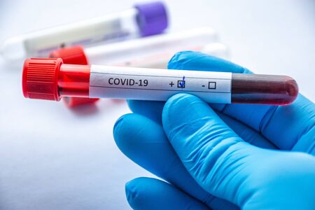 Laboratory diagnosis of coronavirus or COVID-19 concept photos. In close-up frame of doctor...