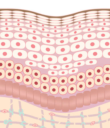 Damaged Skin Aging Stain Cross Sectionの写真素材