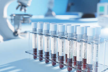 medical laboratory with microscope, biochemical fluid analyzer and blood samples in test tubes to...