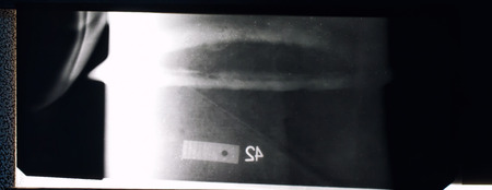 X-ray of a welded seam of the pipeline with an invalid size defects