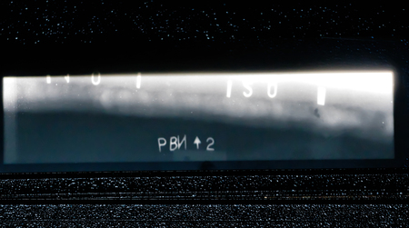 X-ray of the gas pipeline pipe weld with a large slag inclusion in the shape of a heart in the right...