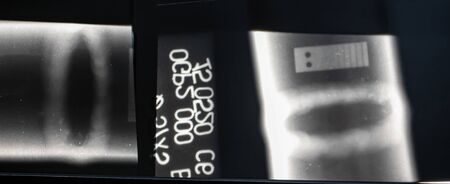 X-ray image of a welding seam without  internal inclusionsの写真素材