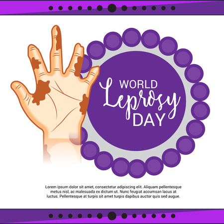 World Leprosy day vector. Hand with scars.のイラスト素材
