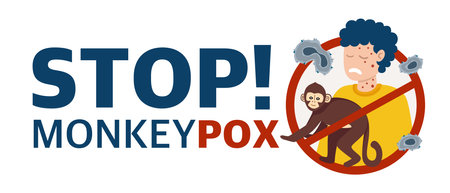 Monkey Pox virus Poster to inform about the pandemic and spread of the disease Images of human virus and monkey Vectorのイラスト素材