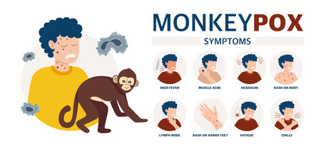 Monkey pox virus Poster to inform about the pandemic and the spread of the disease Images of a person and of the disease Vectorのイラスト素材