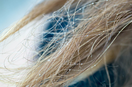 Water and ice drops on hairの写真素材