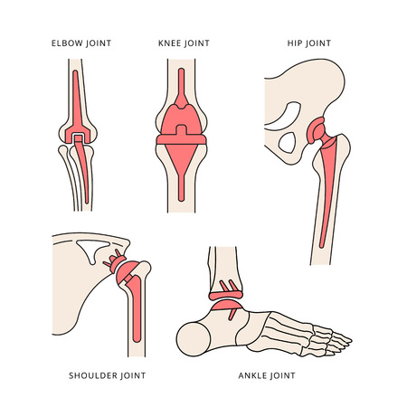 Implantation joint skeletonのイラスト素材