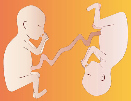 Twin fetuses in yellow gradient background のイラスト素材