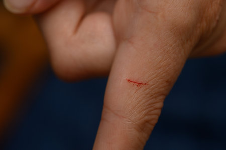 Woman with a Cut Finger and Visible Painの写真素材