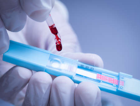 Medical doctor or laborant holding tube with nCoV Coronavirus vaccine for 2019-nCoV COVID virus