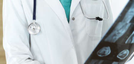 Unknown female doctor standing and holding x-ray picture in clinic, close-up. Medicine conceptの写真素材