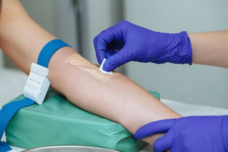 Cropped image of nurse preparing patient to do a blood analysis with veins viewer device. Nurse disinfecting patient's arm by cotton swab.の写真素材