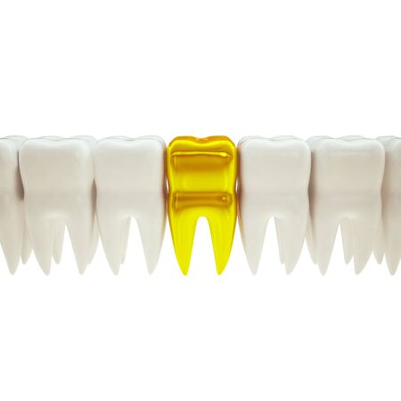 3d illustration of a row of teeth with gold toothの写真素材