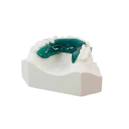 Gypsum model of human jaw on a white backgroundの写真素材