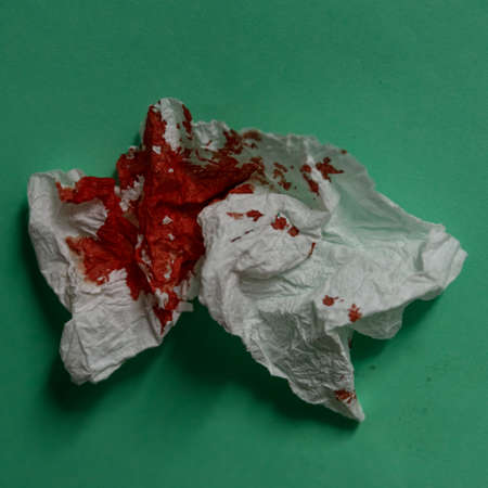 Blood on the hygiene napkin Bloody wound Skincare mockup for design Stack of disposable napkins on a...