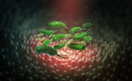 Bowel infection, upset stomach, germs and viruses in body. Intestinal walls and viral inflammation...