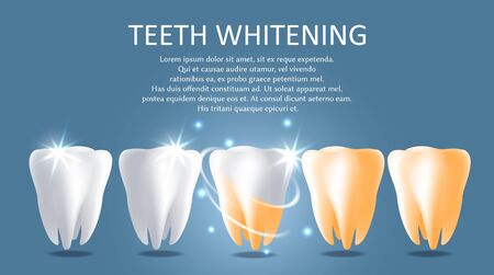 Teeth whitening vector medical poster banner templateのイラスト素材